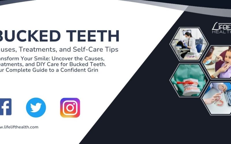 Bucked Teeth: Causes, Treatments, and Self-Care Tips