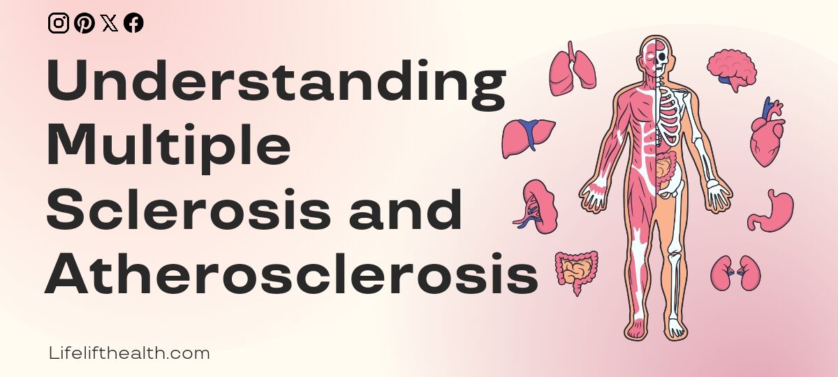 Understanding Multiple Sclerosis and Atherosclerosis