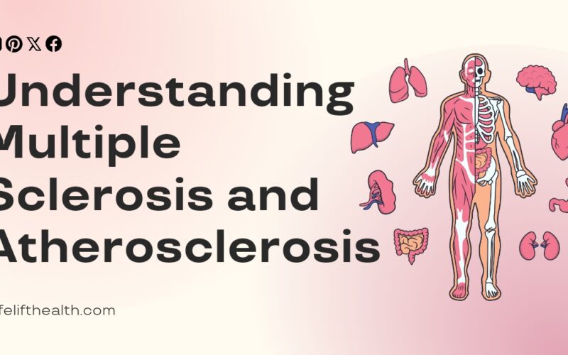 Understanding Multiple Sclerosis and Atherosclerosis