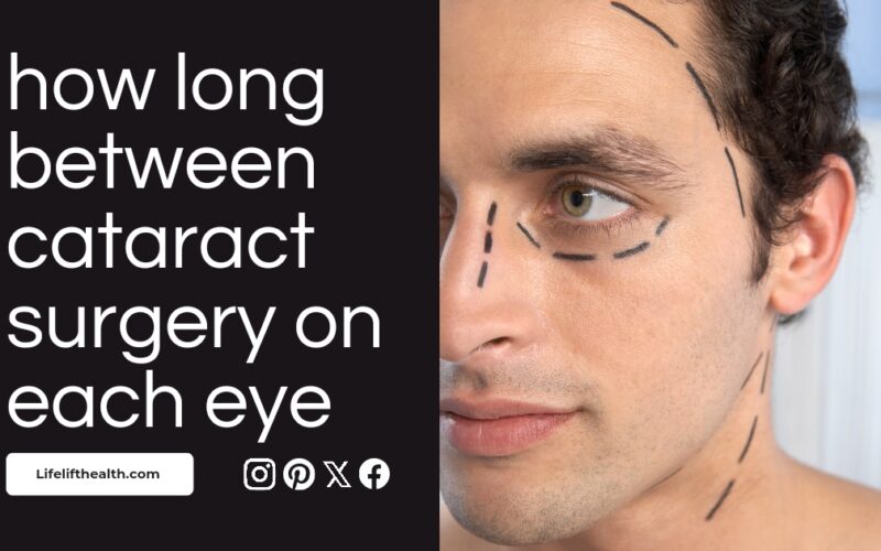 How Long Between Cataract Surgery on Each Eye
