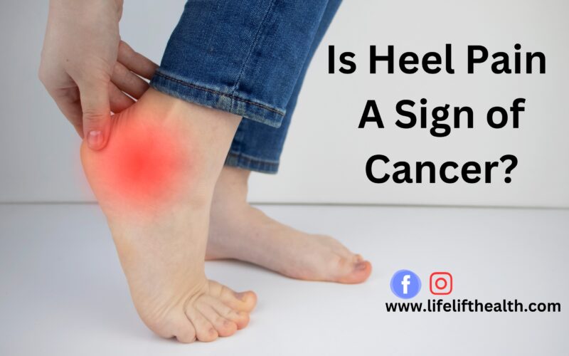 Is Heel Pain: A Sign of Cancer?